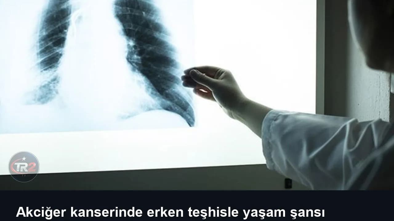 Akciğer kanserinde erken teşhisle yaşam şansı yüzde 90'ı aşıyor