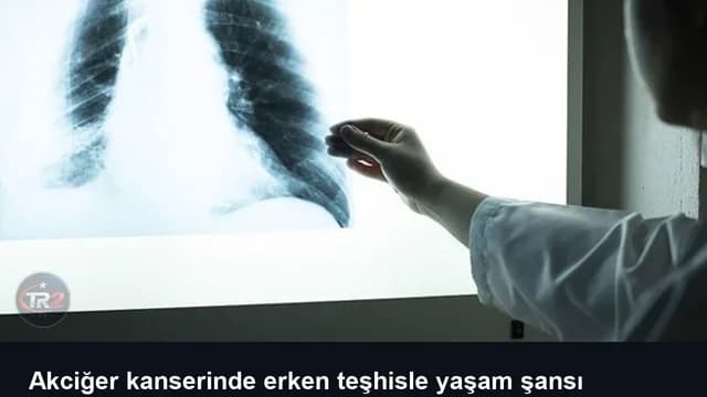 Akciğer kanserinde erken teşhisle yaşam şansı yüzde 90'ı aşıyor