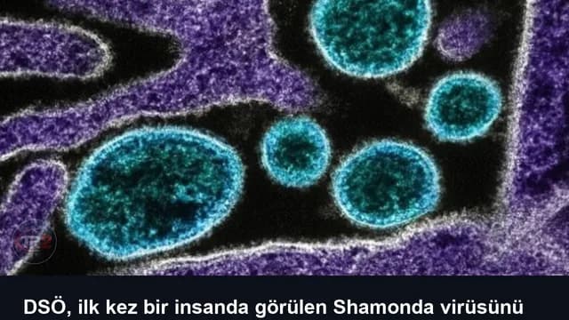 DSÖ, ilk kez bir insanda görülen Shamonda virüsünü araştırıyor