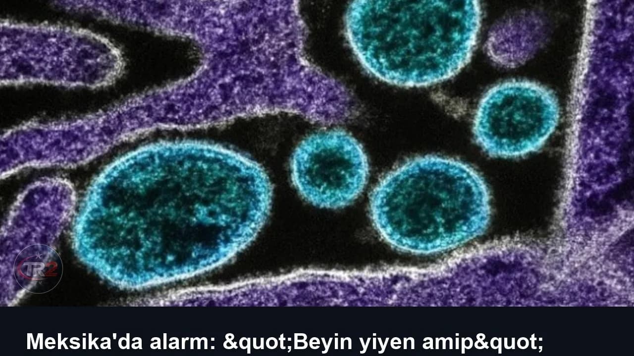 Meksika'da alarm: "Beyin yiyen amip" tespit edilmesinin ardından 6 yapay göl kapatıldı