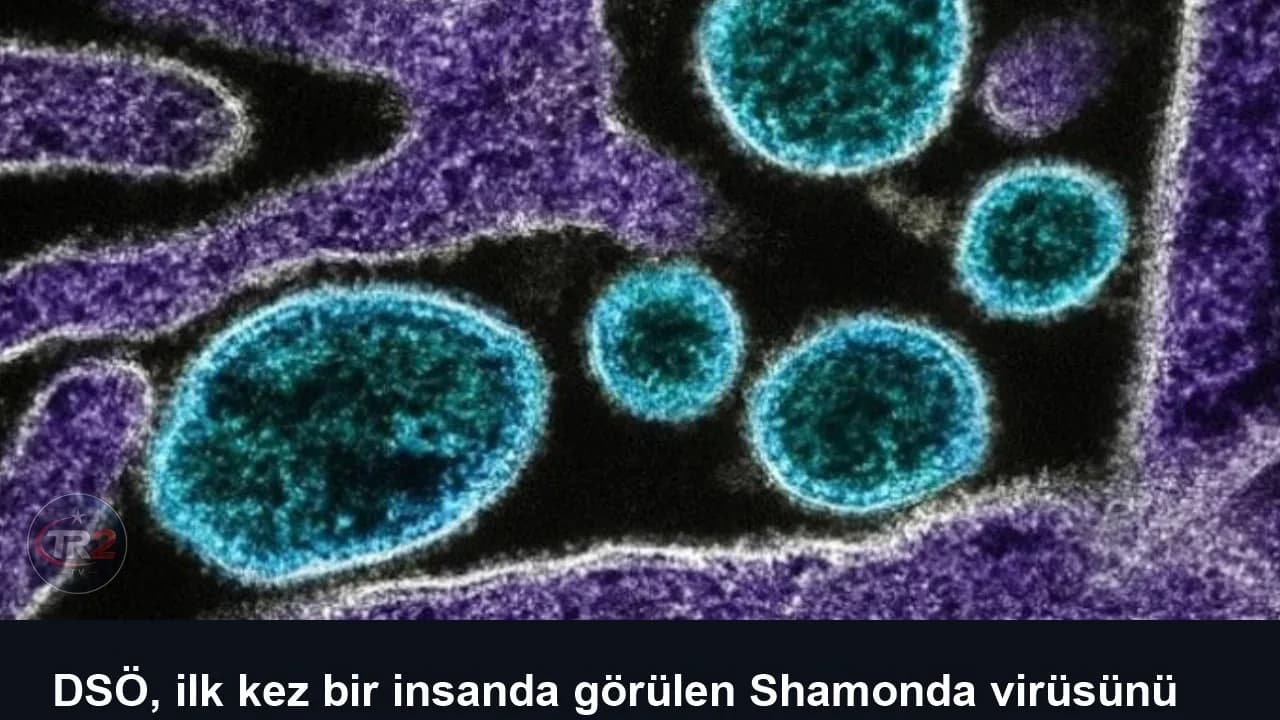 DSÖ, ilk kez bir insanda görülen Shamonda virüsünü araştırıyor
