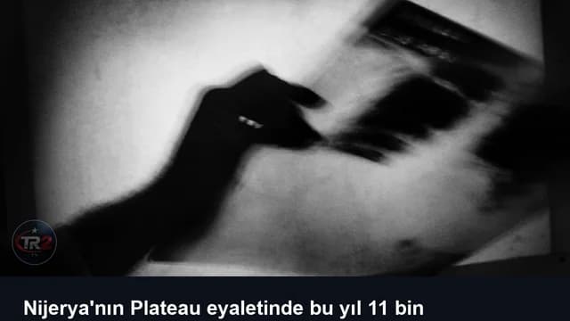 Nijerya'nın Plateau eyaletinde bu yıl 11 bin tüberküloz vakası kayıtlara geçti