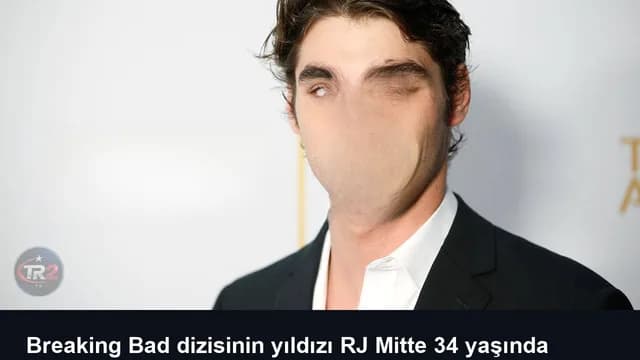 Breaking Bad dizisinin yıldızı RJ Mitte 34 yaşında hayatını kaybetti